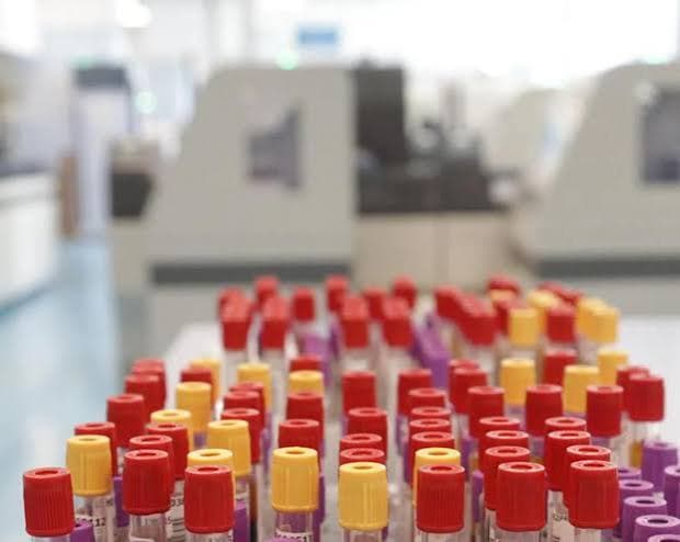 A Francoforte, i casi di malaria salgono a otto: tre morti nell'area dell'aeroporto