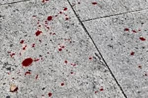 Notte di sangue e follia, tentato omicidio