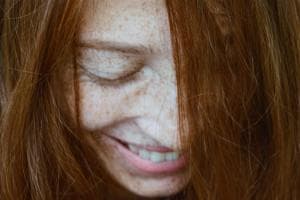 A 17 anni torna a sorridere grazie al 3D